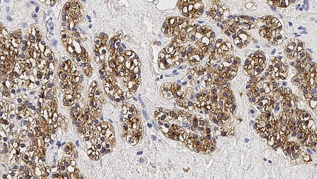 parathyroid hormone cells