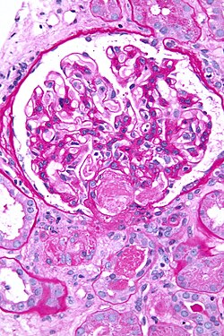kidney pathology microscope image