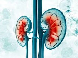 Kidney image
