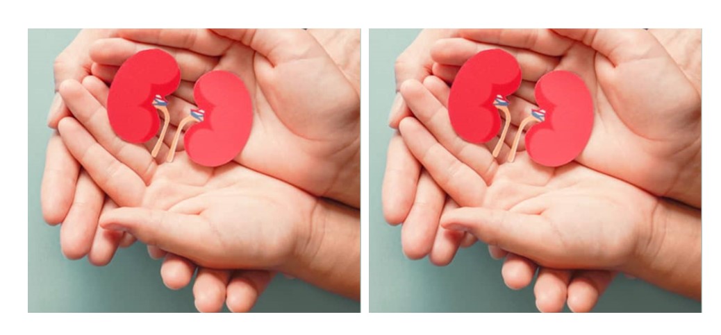 kidneys in hands