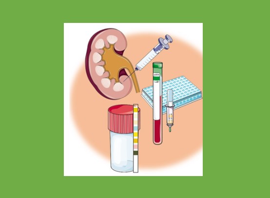 kidney image with lab tools