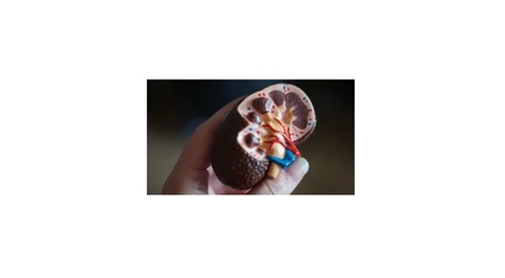 kidney model in hand