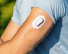 CGM on arm