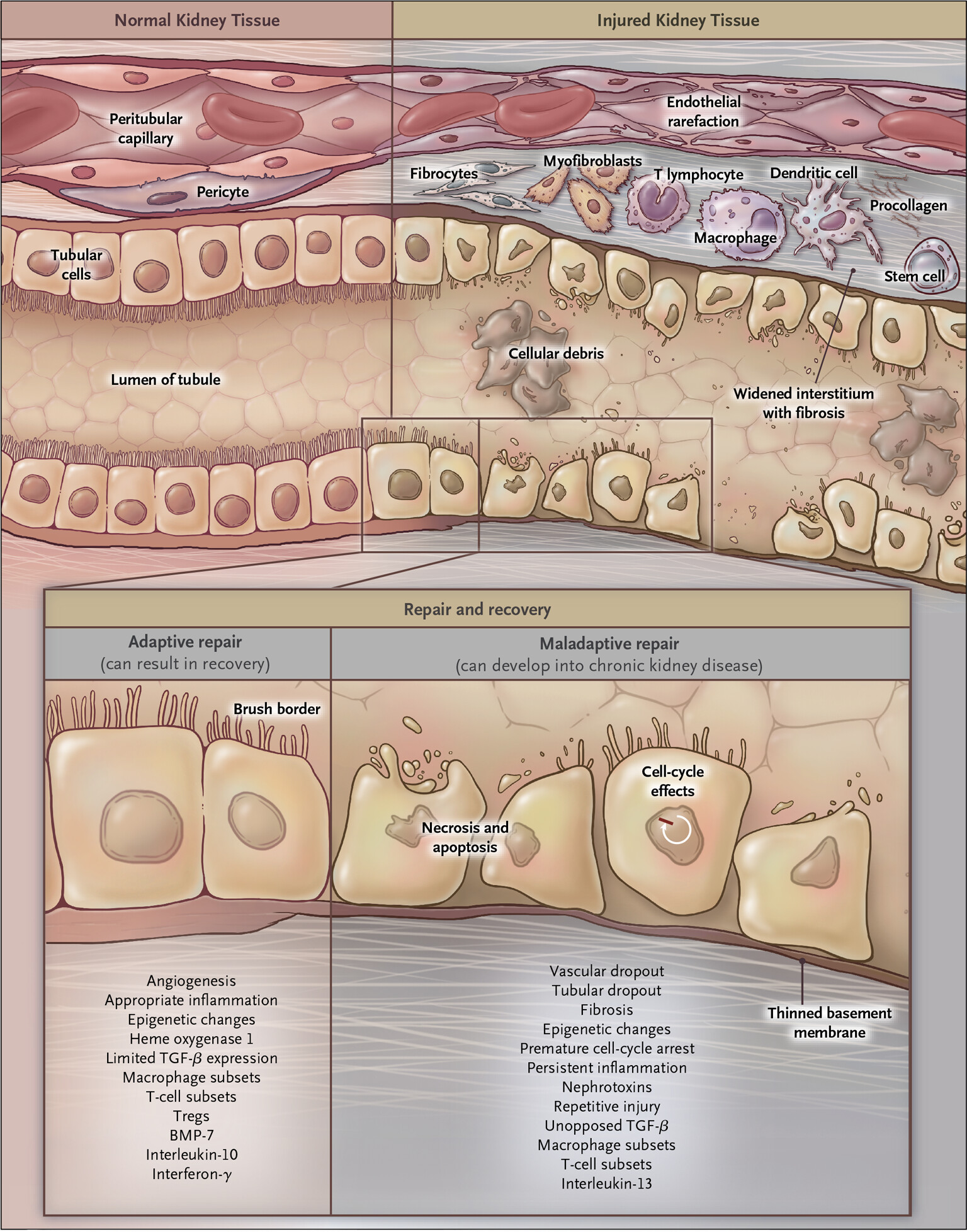 kidney injury image