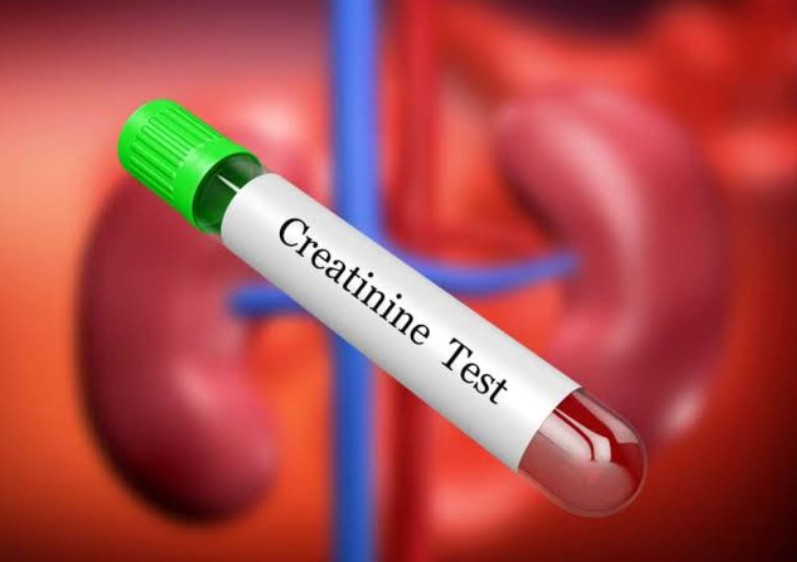 creatinine test image