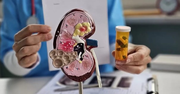 kidney model