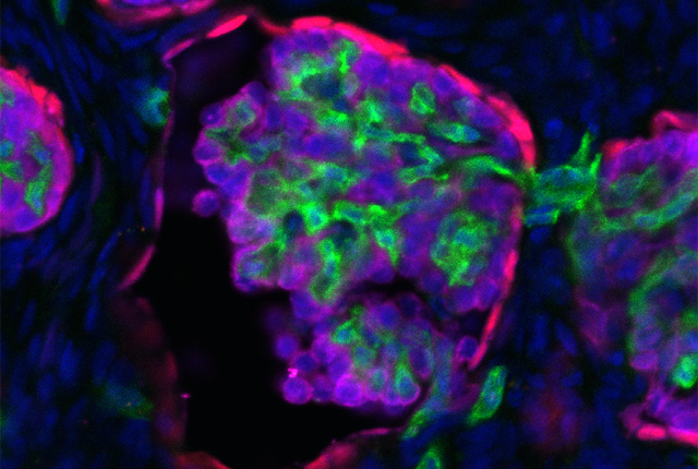 mouse kidney tissue